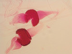 MISSING THUMBNAIL